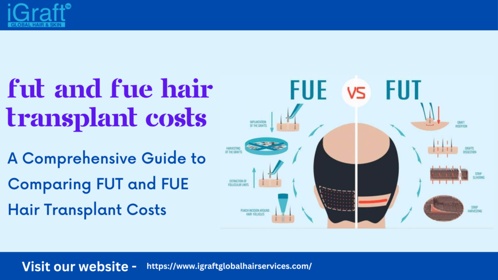 Comparing FUT and FUE Hair Transplant Costs