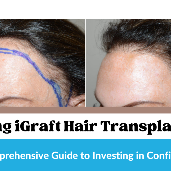 Unveiling iGraft Hair Transplant Costs