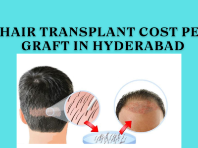 iGraft Hyderabad