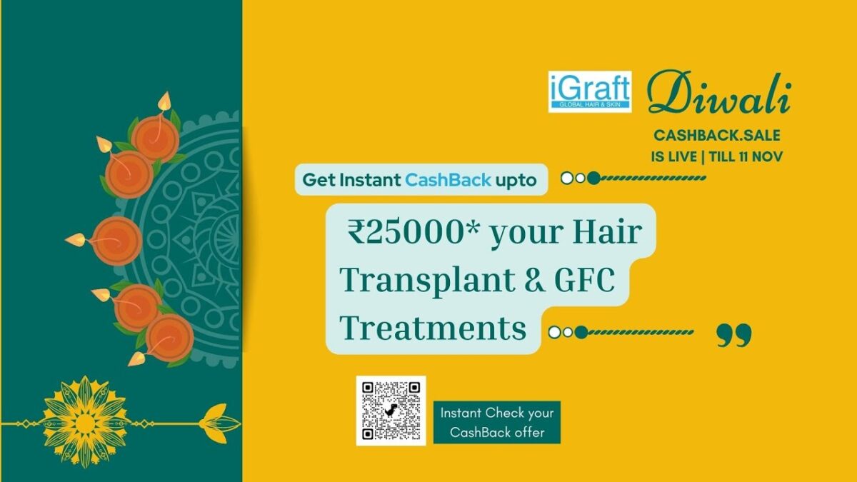 Diwali offer Best hair transplant