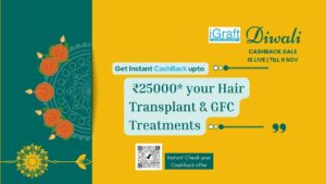 Diwali offer Best hair transplant 