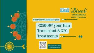 Diwali offer Best hair transplant