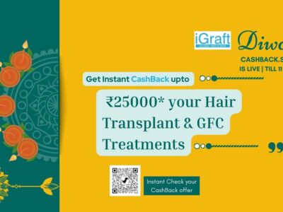 Diwali offer Best hair transplant