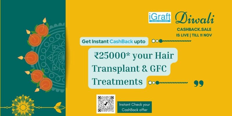 Diwali offer Best hair transplant