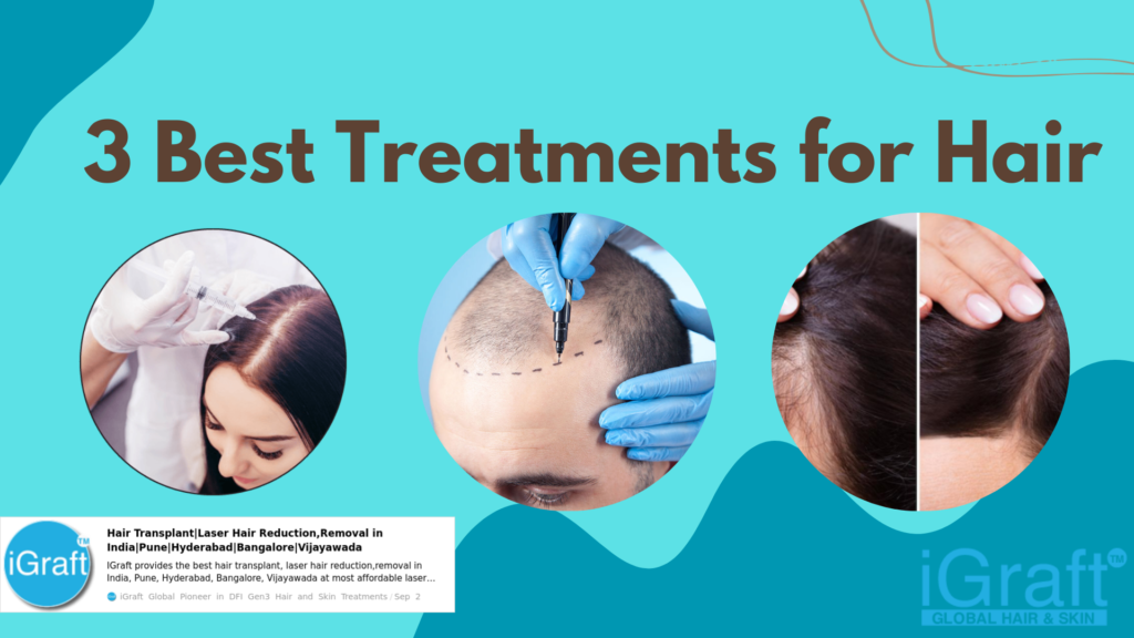 3 Best Treatments for Hair