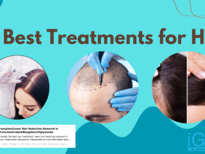 3 Best Treatments for Hair