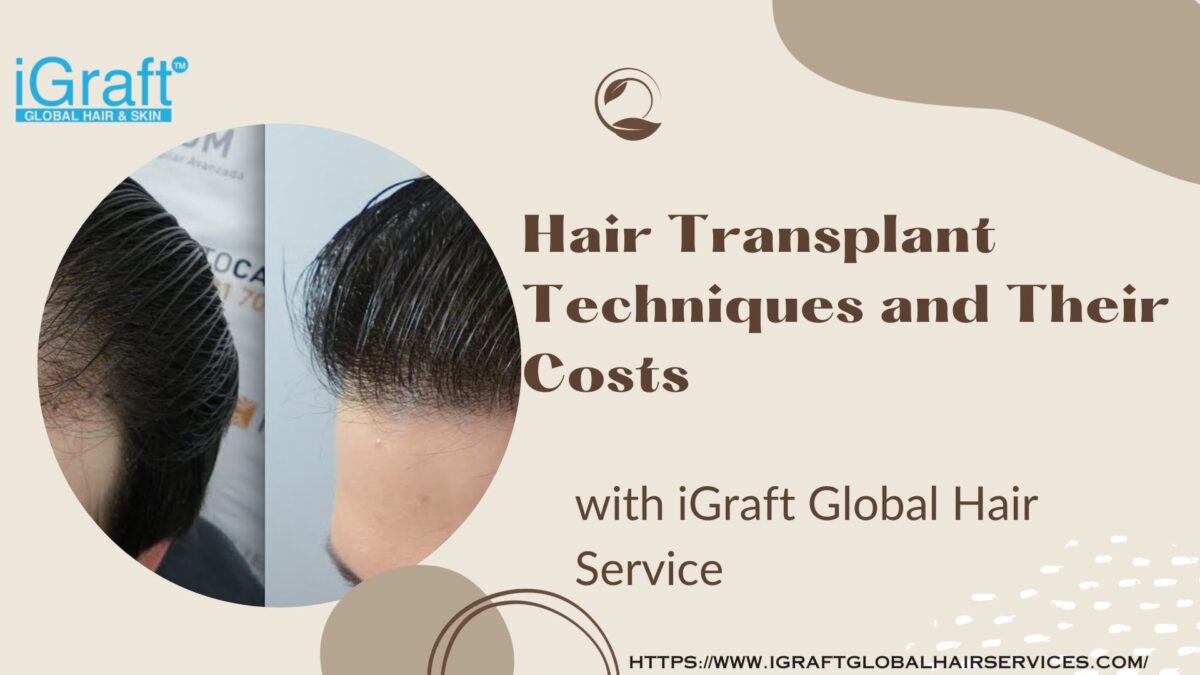 Hair Transplant Techniques and Their Costs