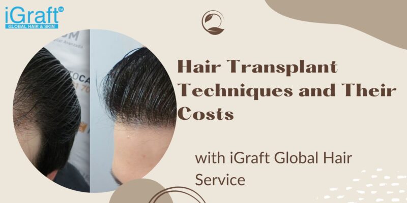Hair Transplant Techniques and Their Costs