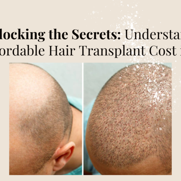 Affordable Hair Transplant Cost in India