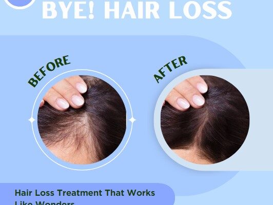 Hair loss treatment