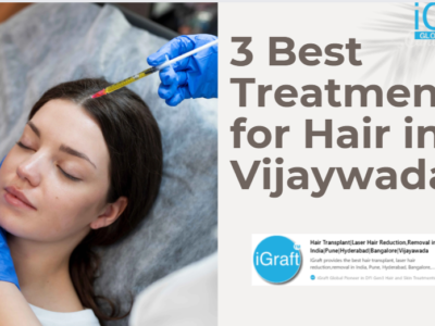 3 Best Treatments for Hair in Vijaywada