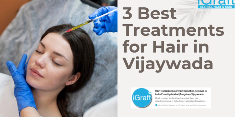3 Best Treatments for Hair in Vijaywada
