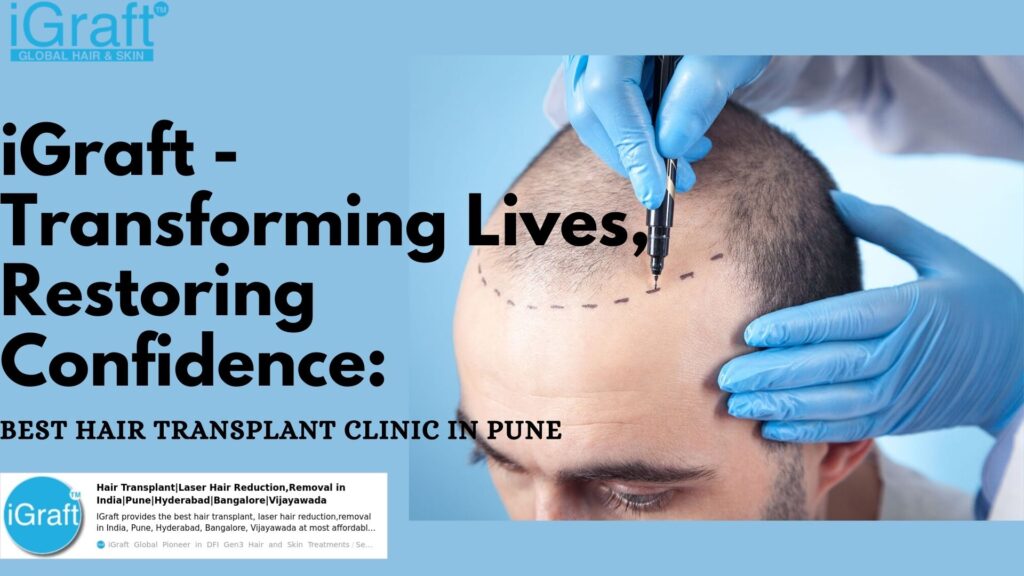 Best Hair Transplant Clinic in Pune