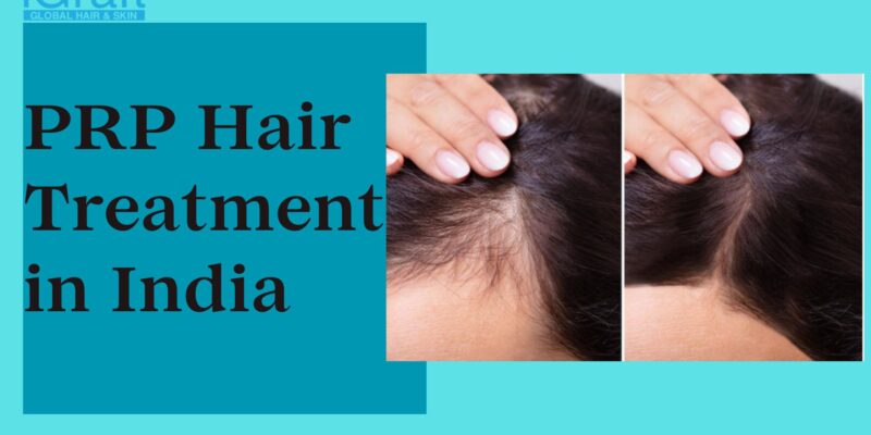 PRP Hair Treatment in India