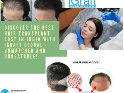 Hair Transplant Cost in India