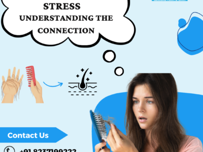 hair loss and stress