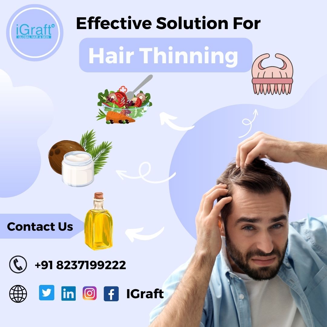 Image showcasing Combating Hair Thinning Effective Solutions and measures