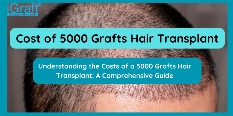 Cost of 5000 Grafts Hair Transplant