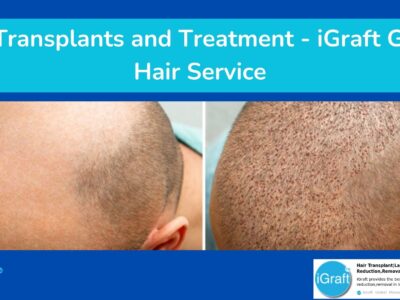 Hair Transplants and Treatment