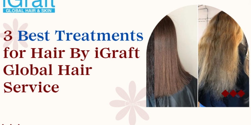 3 Best Treatments for Hair By iGraft Global Hair Service