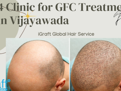 4 Clinic for GFC Treatment in Vijayawada