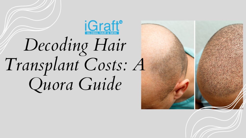 Hair Transplant Cost Quora