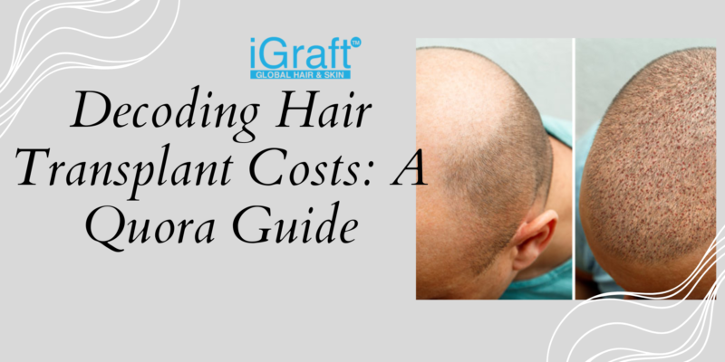 Hair Transplant Cost Quora