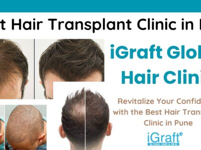 Best Hair Transplant Clinic in India -iGraft Global Hair Clinic