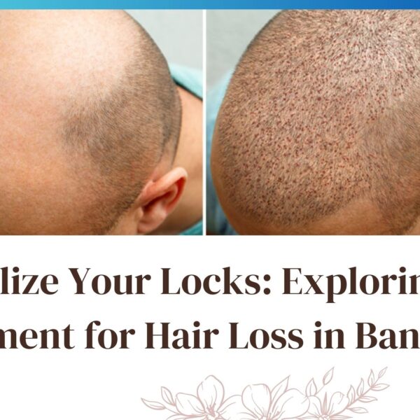 GFC Treatment for Hair Loss in Bangalore
