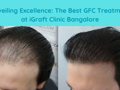 Best GFC Treatment In Bangalore | iGraft Clinic Bangalore