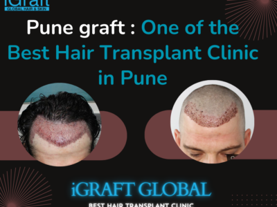 Pune iGraft