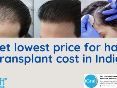 Get lowest price for hair transplant cost in India