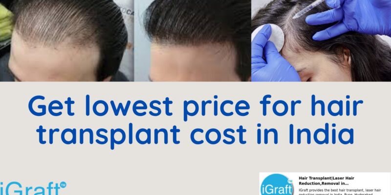 Get lowest price for hair transplant cost in India
