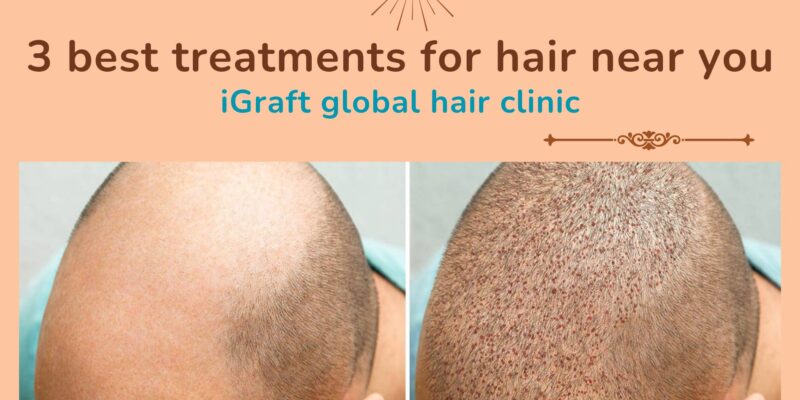 3 best treatments for hair near you