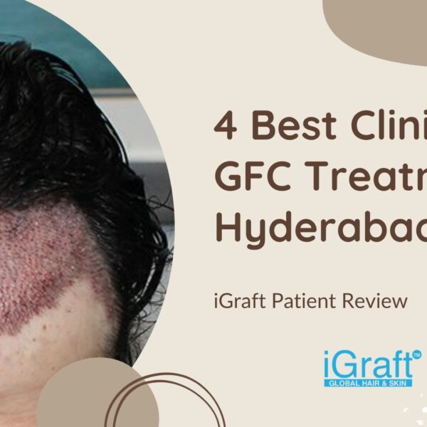 4 Best Clinic for GFC Treatment Hyderabad