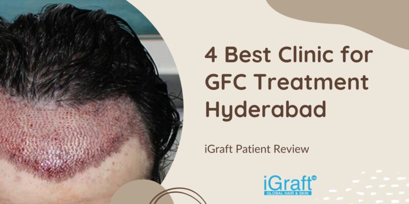 4 Best Clinic for GFC Treatment Hyderabad