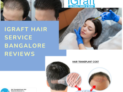 iGraft Hair Service Bangalore Reviews