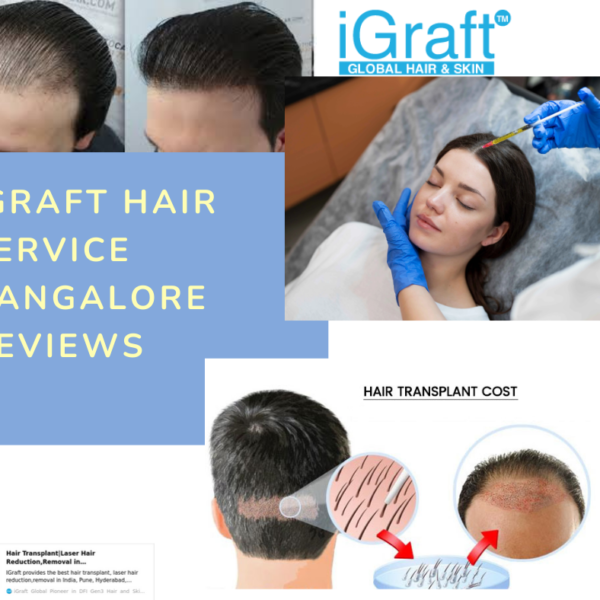 iGraft Hair Service Bangalore Reviews