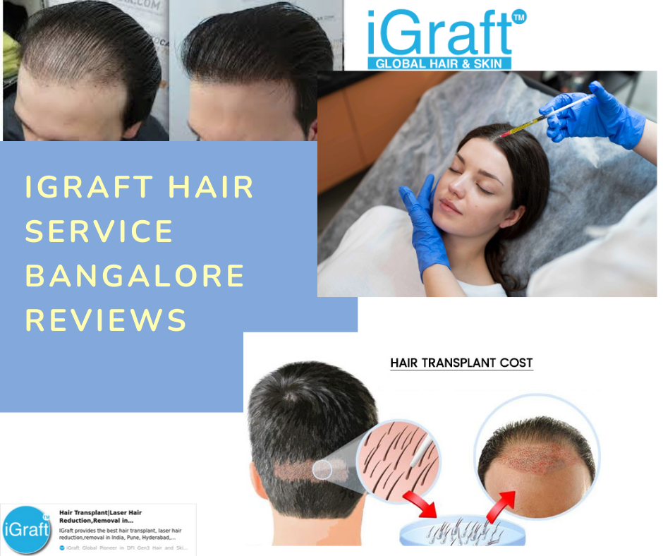 iGraft Hair Service Bangalore Reviews