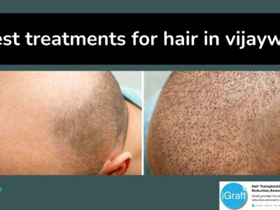 3 best treatments for hair in vijaywada