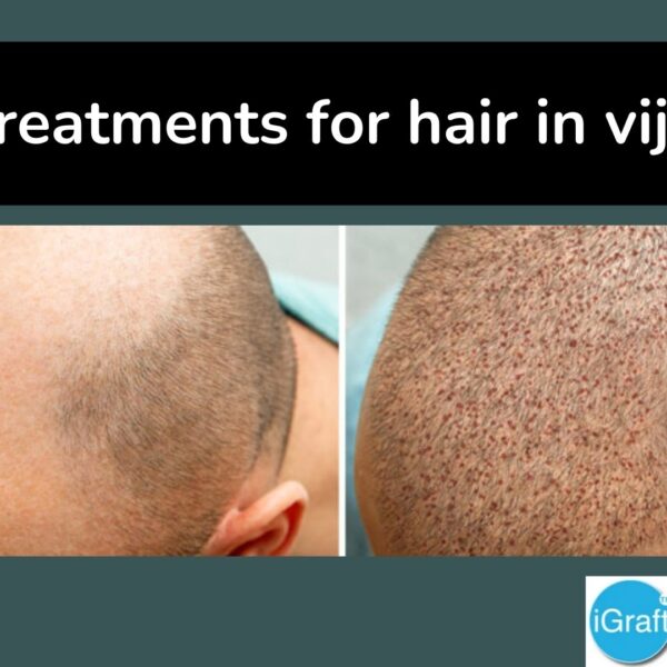 3 best treatments for hair in vijaywada