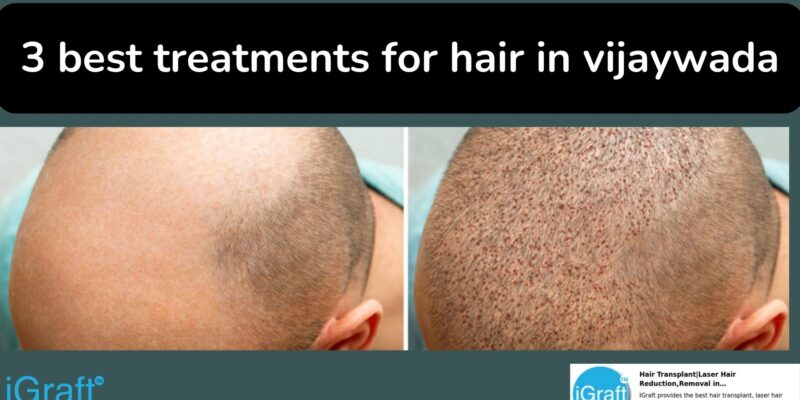 3 best treatments for hair in vijaywada