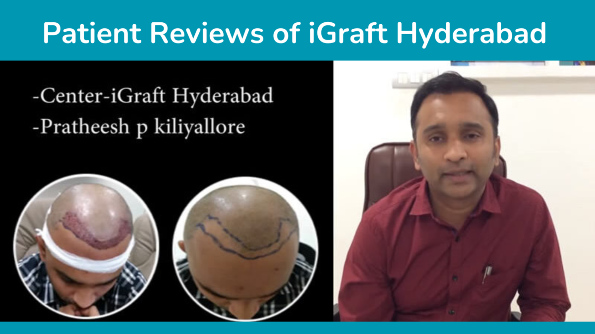 Patient Reviews of iGraft Hyderabad