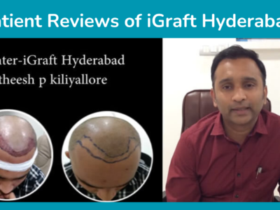 Patient Reviews of iGraft Hyderabad