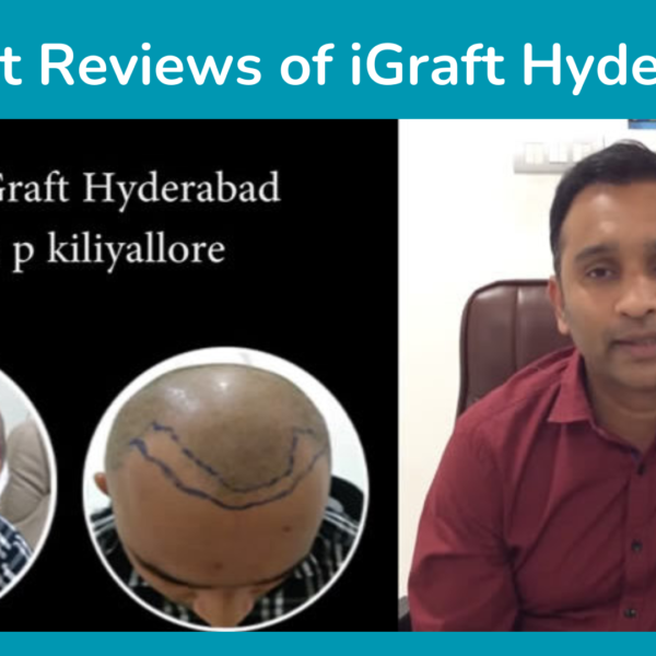 Patient Reviews of iGraft Hyderabad