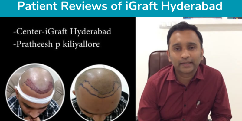 Patient Reviews of iGraft Hyderabad