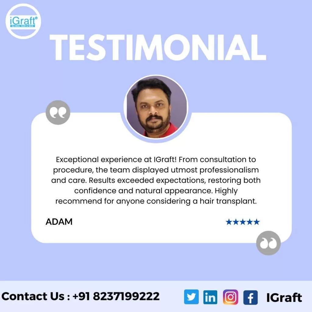 Igraft Reviews