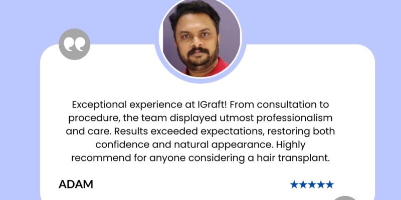 Igraft Reviews