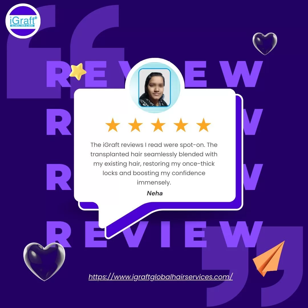 Igraft Reviews
