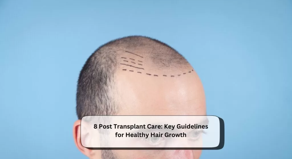 Post Transplant Care
